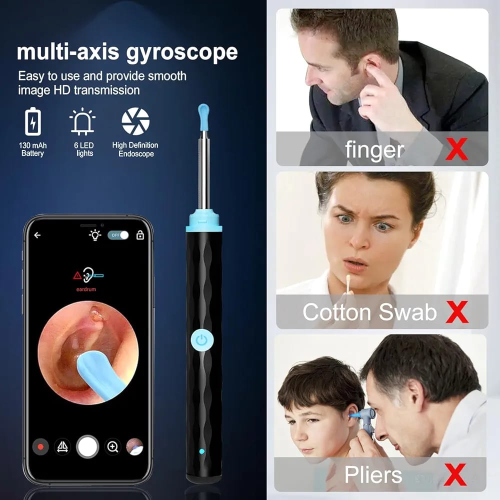 Ear Cleaner Camera HD – Smart Ear Wax Removal Tool with Live View & Safe Cleaning