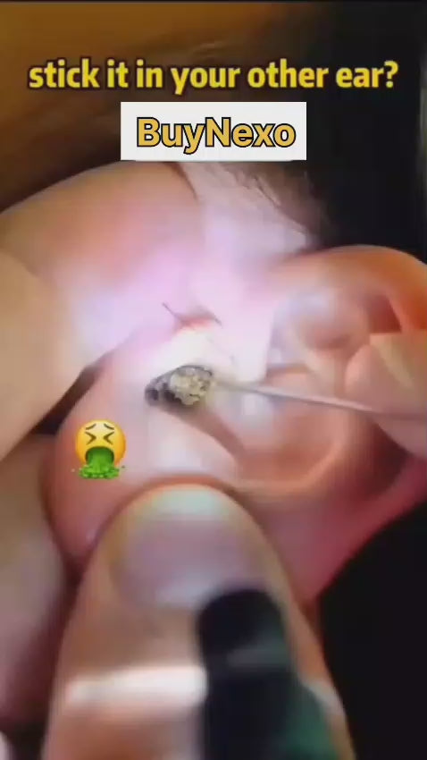 Ear Cleaner Camera HD – Live View Ear Cleaning Tool | Free Delivery + Cash on Delivery All Over Pakistan